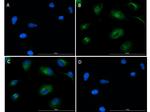 Phospho-SMAD2 (Ser467) Polyclonal Antibody
