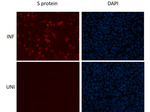 SARS-CoV-2 Spike Protein RBD Antibody in Immunocytochemistry (ICC/IF)
