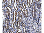 GST pi Polyclonal Antibody
