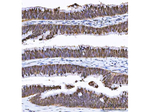 GST pi Antibody in Immunohistochemistry (Paraffin) (IHC (P))