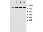 NMDAR2B Polyclonal Antibody