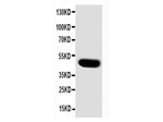 SKP2 Antibody in Western Blot (WB)