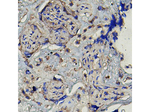 MMP16 Antibody in Immunohistochemistry (Paraffin) (IHC (P))