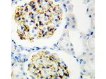 CD34 Antibody in Immunohistochemistry (Paraffin) (IHC (P))