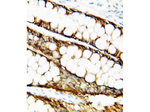 TIMP1 Antibody in Immunohistochemistry (Paraffin) (IHC (P))