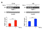 TIMP1 Antibody in Western Blot (WB)