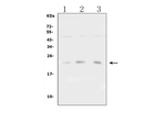 TIMP1 Antibody in Western Blot (WB)