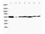 MAPK 8/9 Antibody in Western Blot (WB)