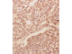 GDNF Polyclonal Antibody