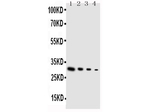 GDNF Antibody in Western Blot (WB)