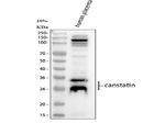 Canstatin Antibody in Western Blot (WB)