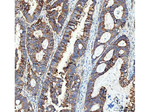 ITGA3 Antibody in Immunohistochemistry (Paraffin) (IHC (P))