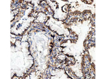 ITGA3 Antibody in Immunohistochemistry (Paraffin) (IHC (P))