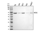NOX2 Antibody in Western Blot (WB)