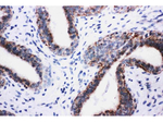 PIK3R2 Polyclonal Antibody