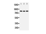 PIK3R2 Antibody in Western Blot (WB)