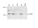 PHF8 Polyclonal Antibody
