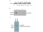 AML-ETO Polyclonal Antibody