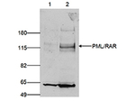 PML Antibody in Western Blot (WB)