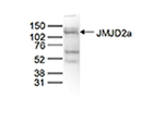 JMJD2A Polyclonal Antibody