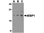 4EBP1 Antibody in Western Blot (WB)