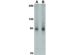 AAK1 Antibody in Western Blot (WB)