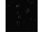 ABCA7 Polyclonal Antibody