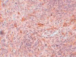 ABIN3 Polyclonal Antibody
