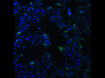 ACE2 Antibody in Immunocytochemistry (ICC/IF)