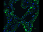 ACE2 Antibody in Immunocytochemistry (ICC/IF)