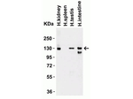 ACE2 Antibody in Western Blot (WB)