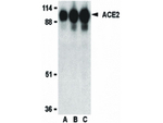 ACE2 Antibody in Western Blot (WB)
