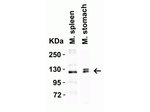 ACE2 Antibody in Western Blot (WB)