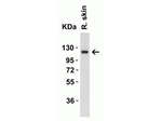 ACE2 Antibody in Western Blot (WB)
