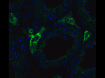 ACE2 Antibody in Immunocytochemistry (ICC/IF)
