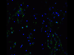 ACE2 Antibody in Immunocytochemistry (ICC/IF)