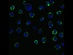 ACE2 Antibody in Immunocytochemistry (ICC/IF)