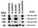 ACE2 Antibody in Western Blot (WB)