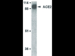 ACE2 Antibody in Western Blot (WB)