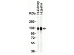 ACE2 Antibody in Western Blot (WB)