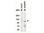 ACE2 Antibody in Western Blot (WB)