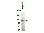 ACE2 Antibody in Western Blot (WB)