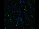 ACE2 Antibody in Immunocytochemistry (ICC/IF)