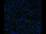 ACE2 Antibody in Immunocytochemistry (ICC/IF)