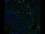 ACE2 Antibody in Immunocytochemistry (ICC/IF)