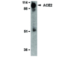 ACE2 Antibody in Western Blot (WB)
