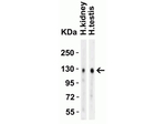 ACE2 Antibody in Western Blot (WB)