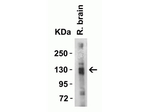 ACE2 Antibody in Western Blot (WB)