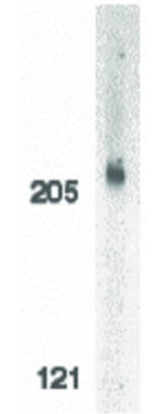 ACINUS Antibody in Western Blot (WB)