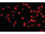 ACINUS Antibody in Immunocytochemistry (ICC/IF)